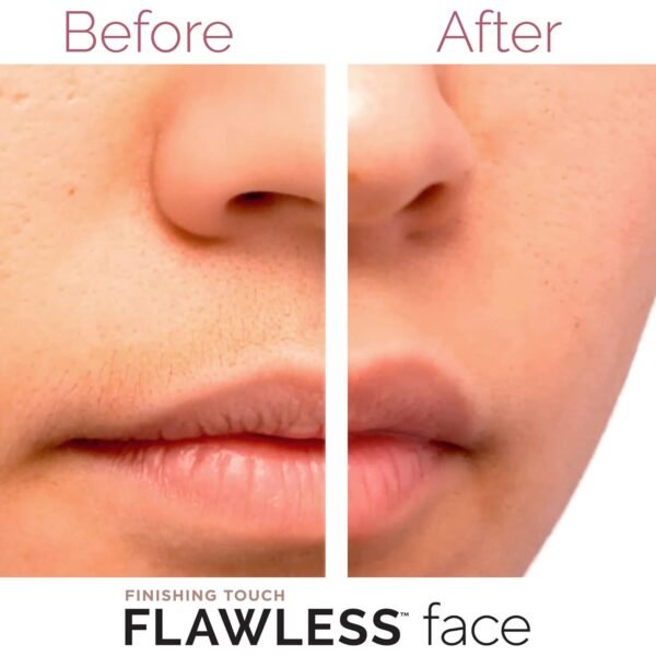 FLAWLESS Facial Hair Removal for Women, Painless Hair Remover Device for Face, Electric Hair Removal for Face, Lips, Chin, Armpit, Fingers, Arms with USB Rechargeable